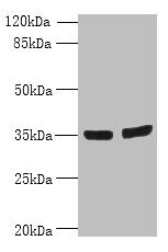 OSR2 Antibody in Western Blot (WB)