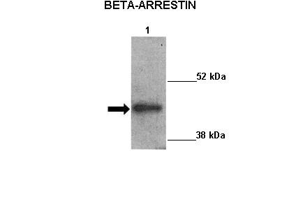 beta-Arrestin 2 Antibody in Western Blot (WB)