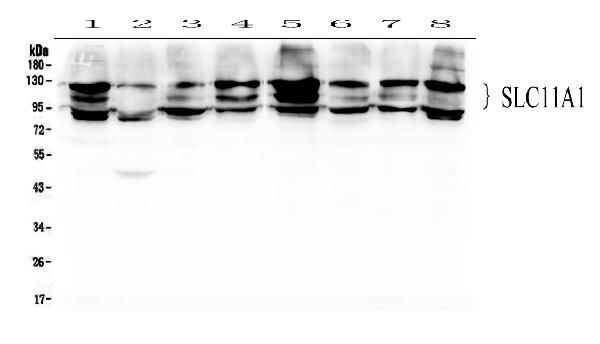 SLC11A1 Antibody in Western Blot (WB)