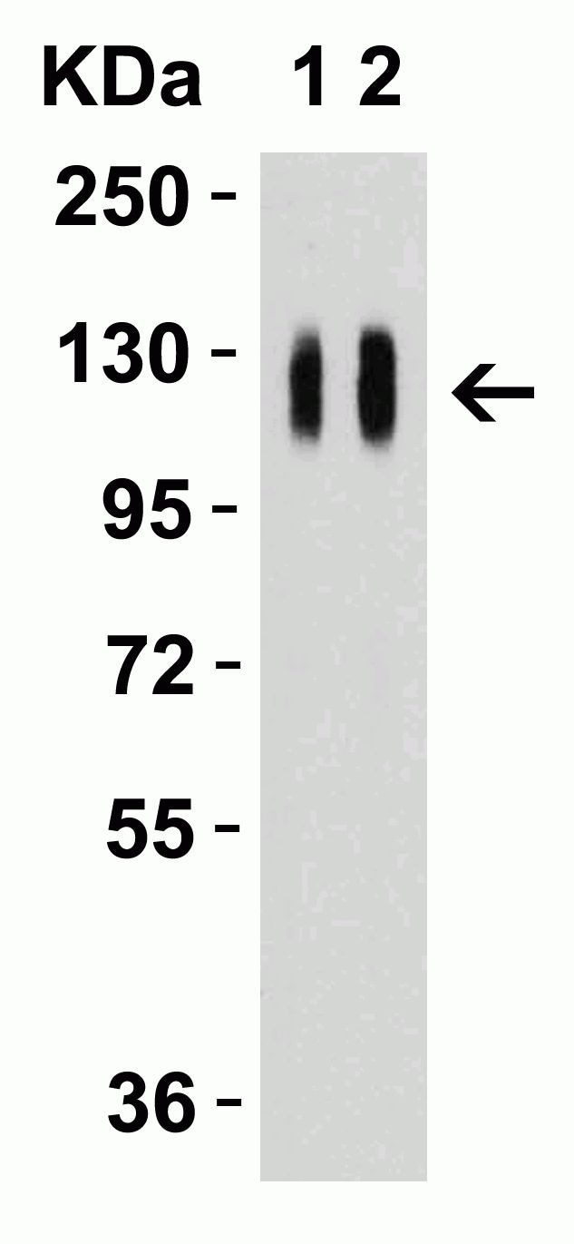 positive spike protein antibody test