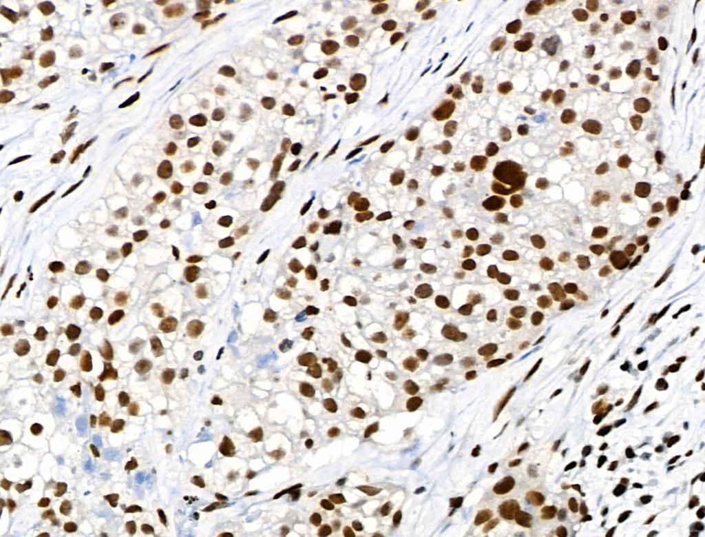 Phospho-SMAD5 (Ser463, Ser465) Antibody in Immunohistochemistry (Paraffin) (IHC (P))