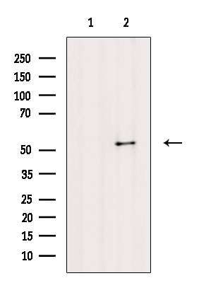 Phospho-SMAD5 (Ser463, Ser465) Antibody in Western Blot (WB)
