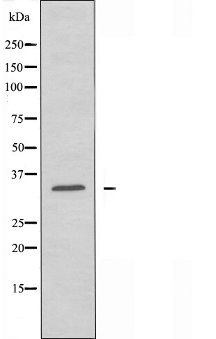 CD32 Antibody in Western Blot (WB)