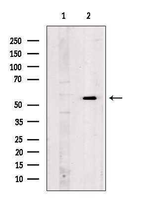 CD7 Antibody in Western Blot (WB)