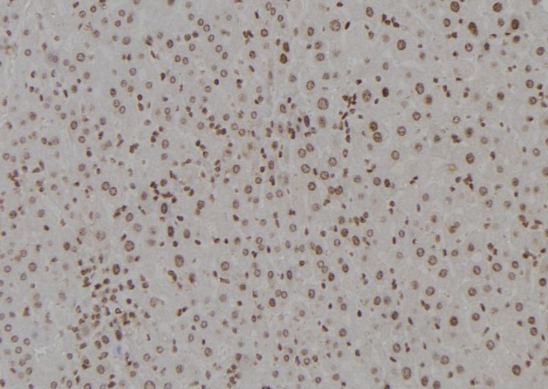DDB1 Antibody in Immunohistochemistry (Paraffin) (IHC (P))