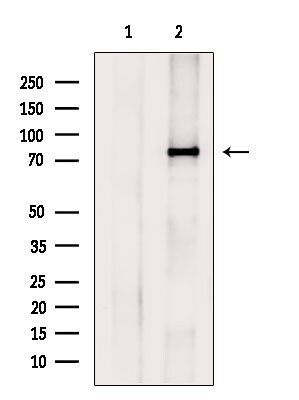 MUM1 Antibody in Western Blot (WB)