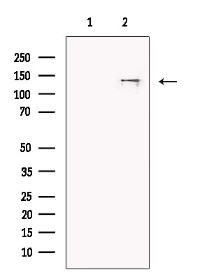 SF3B1 Antibody in Western Blot (WB)