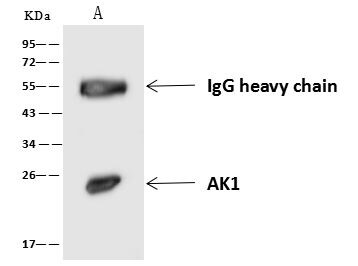Adenylate Kinase 1 Antibody in Immunoprecipitation (IP)