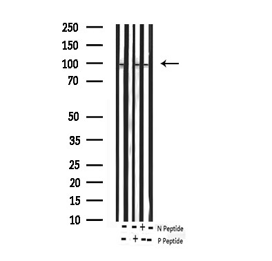 Phospho-FOXO3A (Ser253) Antibody in Western Blot (WB)
