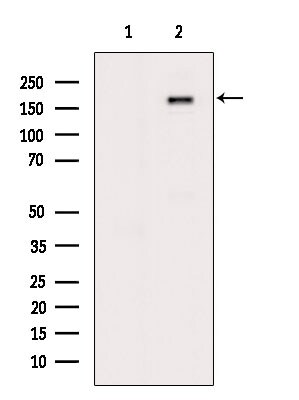 Phospho-IR/IGF1R (Tyr1161) Antibody in Western Blot (WB)