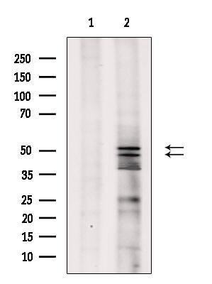 Phospho-JNK1/JNK2/JNK3 (Thr183, Tyr185) Antibody in Western Blot (WB)