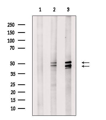 Phospho-JNK1/JNK2/JNK3 (Thr183, Tyr185) Antibody in Western Blot (WB)