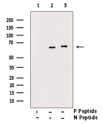 Phospho-NFkB p65 (Ser281) Antibody in Western Blot (WB)