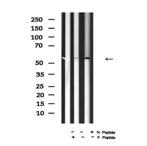 Phospho-HSF1 (Ser307) Antibody in Western Blot (WB)