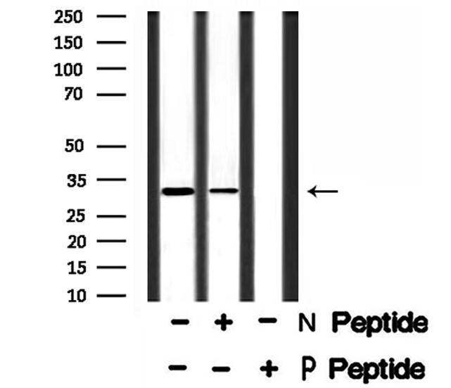 Phospho-PDX1 (Ser66) Antibody in Western Blot (WB)