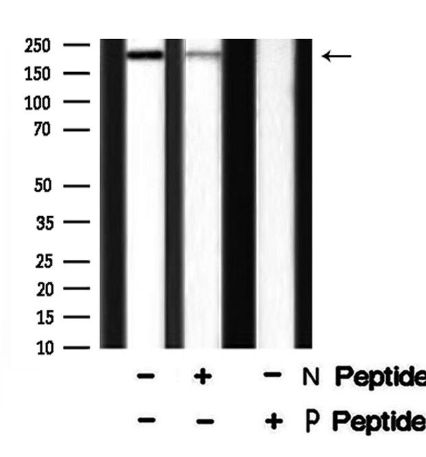 Phospho-TSC2 (Ser981) Antibody in Western Blot (WB)