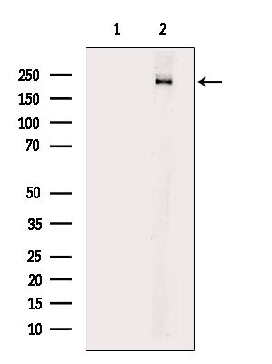Phospho-TSC2 (Ser981) Antibody in Western Blot (WB)
