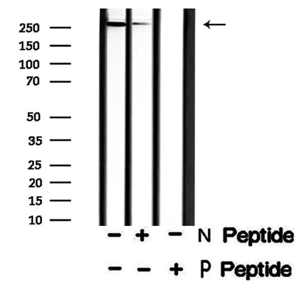 Phospho-POLR2A (Ser2, Ser1616) Antibody in Western Blot (WB)