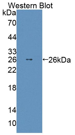 ABCD2 Antibody in Western Blot (WB)