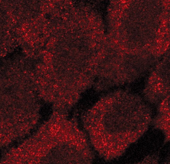 Acetyl-CoA Carboxylase Antibody (PA5-17564)