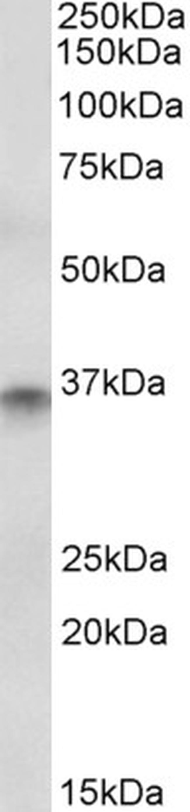 cdx2-antibody-pa5-18492