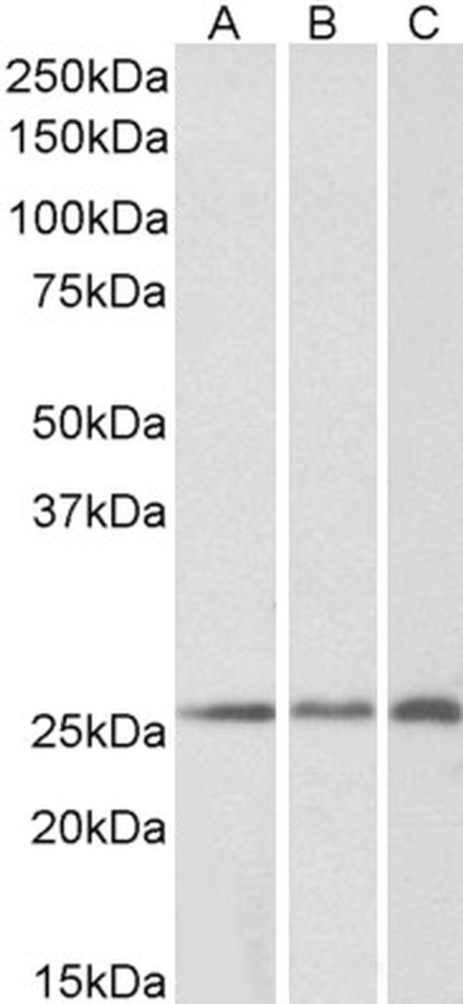 CRP2 Antibody (PA5-18834)