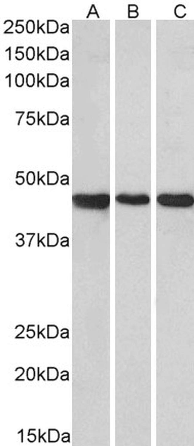 Prokineticin Receptor 2 Antibody in Western Blot (WB)
