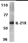 IL21R Antibody in Western Blot (WB)