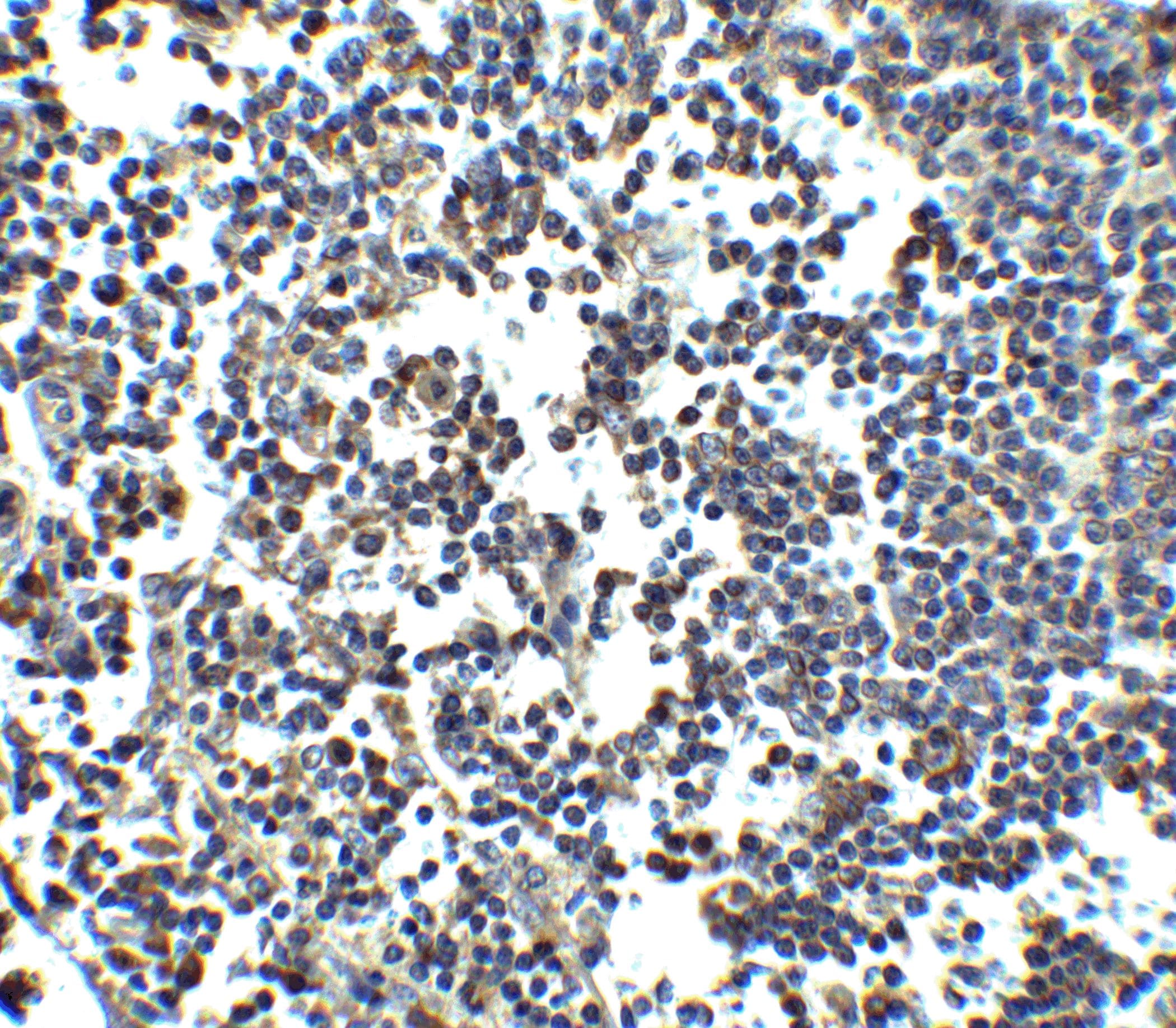 MDA5 Antibody (PA5-20337)