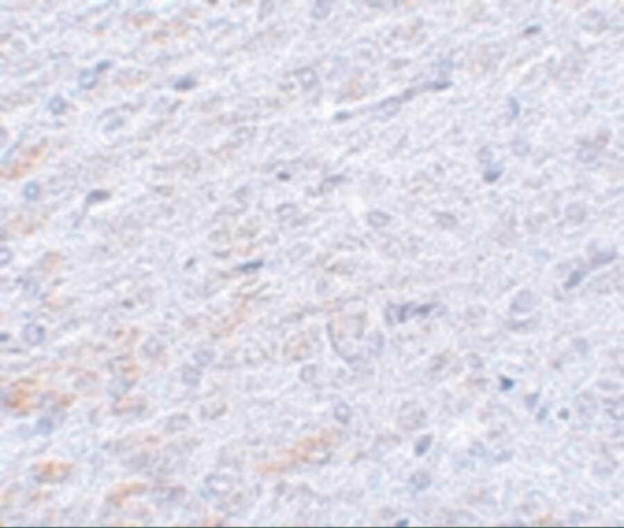 TCF3 Antibody in Immunohistochemistry (IHC)