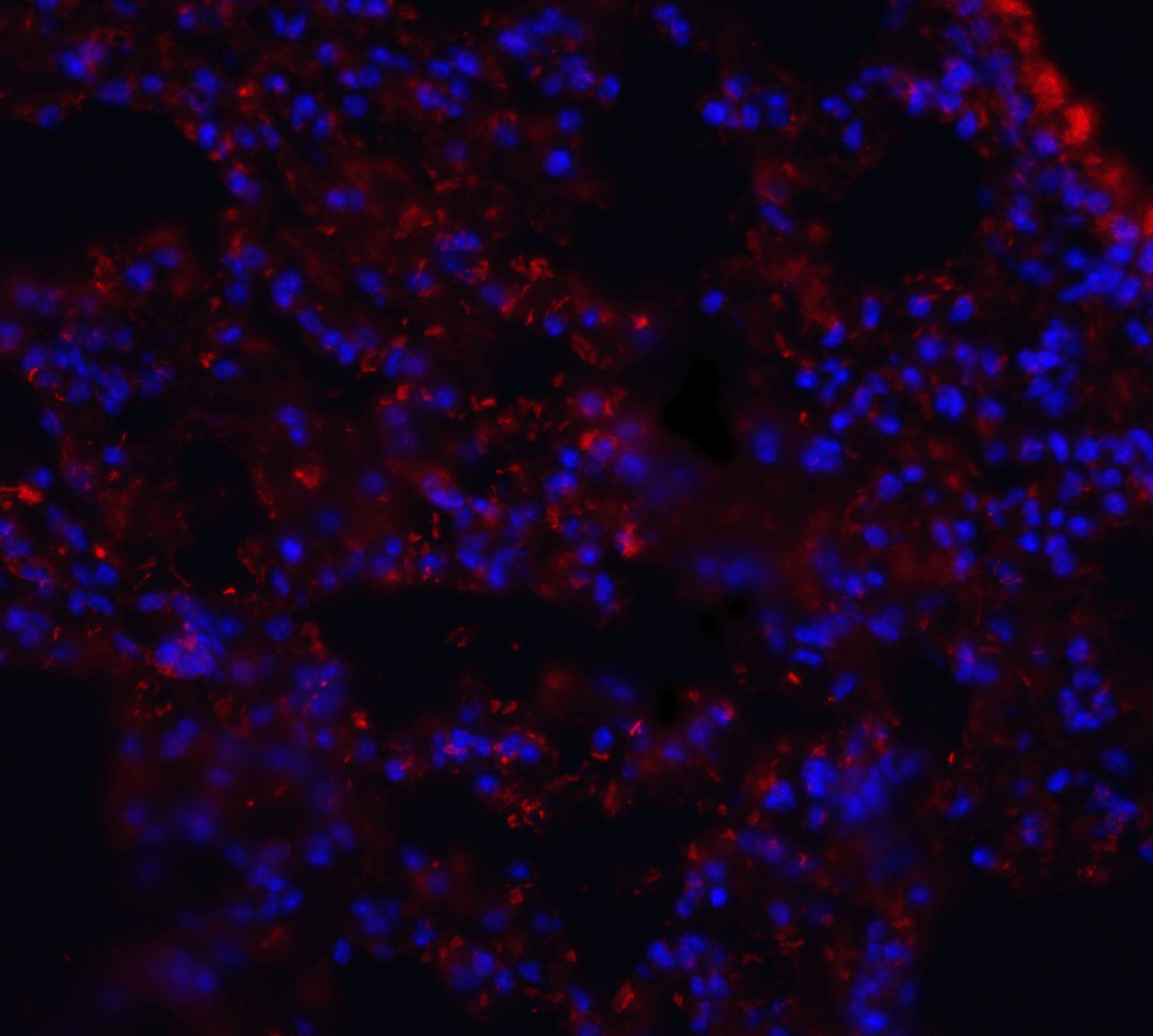 MFSD2A Antibody (PA5-21049)