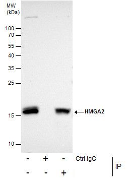 HMGA2 Antibody in Immunoprecipitation (IP)
