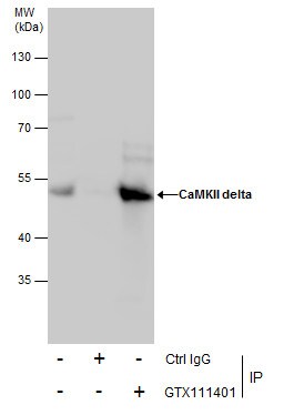CaMKII delta Antibody in Immunoprecipitation (IP)