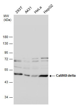 CaMKII delta Antibody in Western Blot (WB)