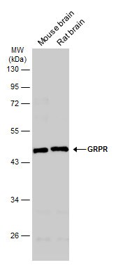 GRPR Antibody (PA5-27073)