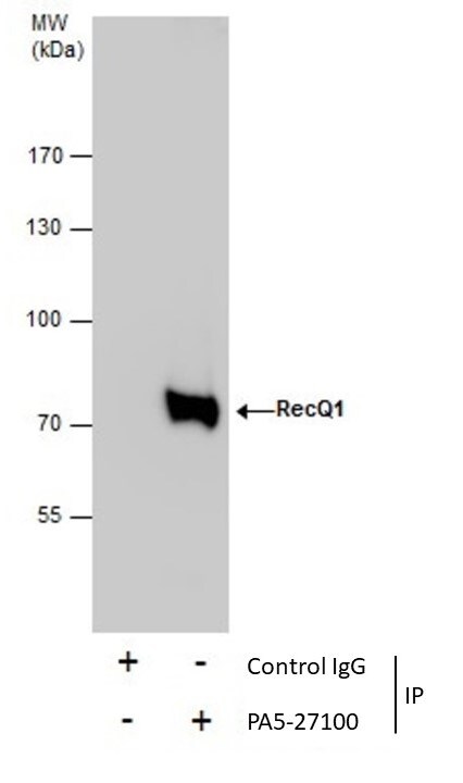 RECQ1 Antibody in Immunoprecipitation (IP)