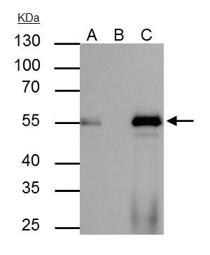 FOXA1 Antibody in Immunoprecipitation (IP)