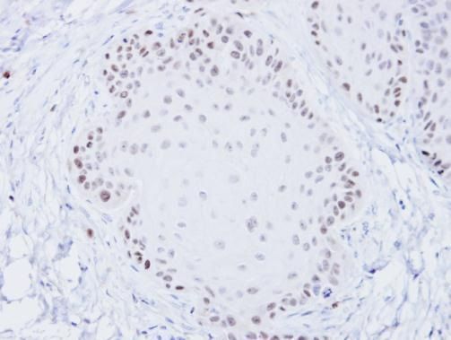 Blooms Syndrome Antibody in Immunohistochemistry (Paraffin) (IHC (P))