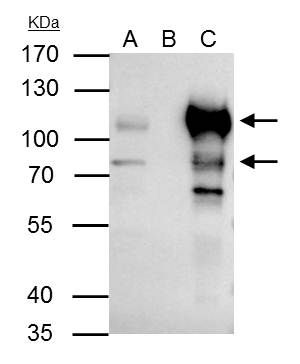 BCL6 Antibody in Immunoprecipitation (IP)
