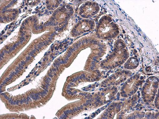 Tgm2 Antibody Pa5 29356