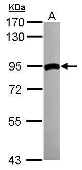 Tgm2 Antibody Pa5 29356
