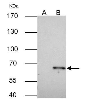 TRAF6 Antibody in Immunoprecipitation (IP)