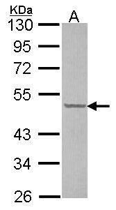 CUGBP1 Antibody in Western Blot (WB)
