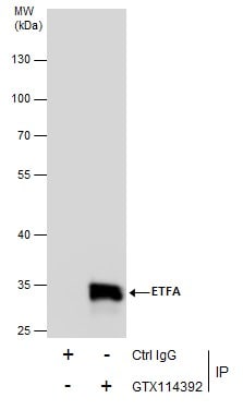 ETFA Antibody in Immunoprecipitation (IP)