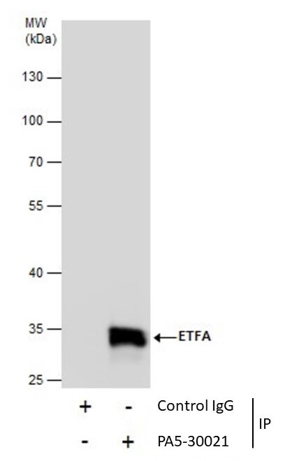 ETFA Antibody in Immunoprecipitation (IP)