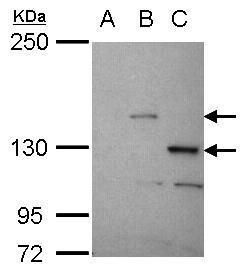 STK31 Antibody in Western Blot (WB)