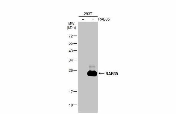 RAB35 Antibody (PA5-31674)