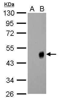 Influenza A H1N1 NA Antibody (PA5-32238)