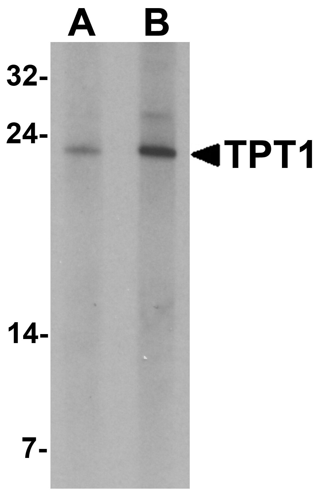 gal 5 1 tpt