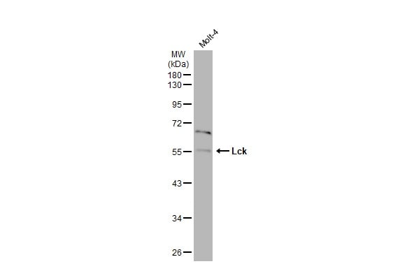 LCK Antibody (PA5-34653)